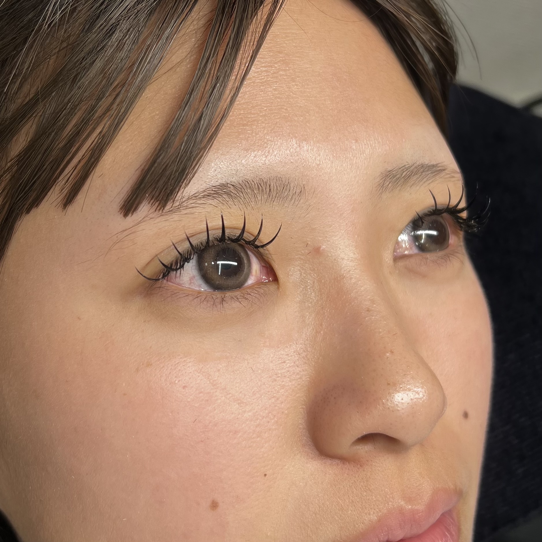 施術事例2
